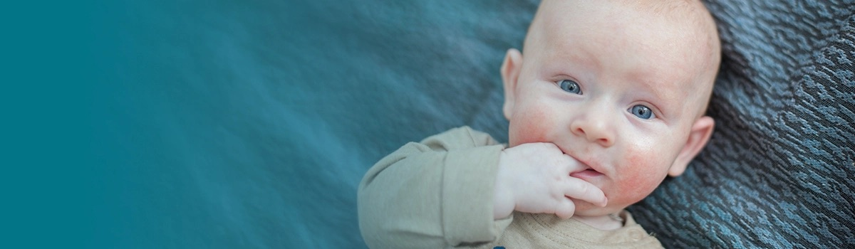 Аллергия у ребёнка