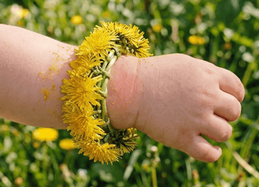 Аллергическая крапивница у детей